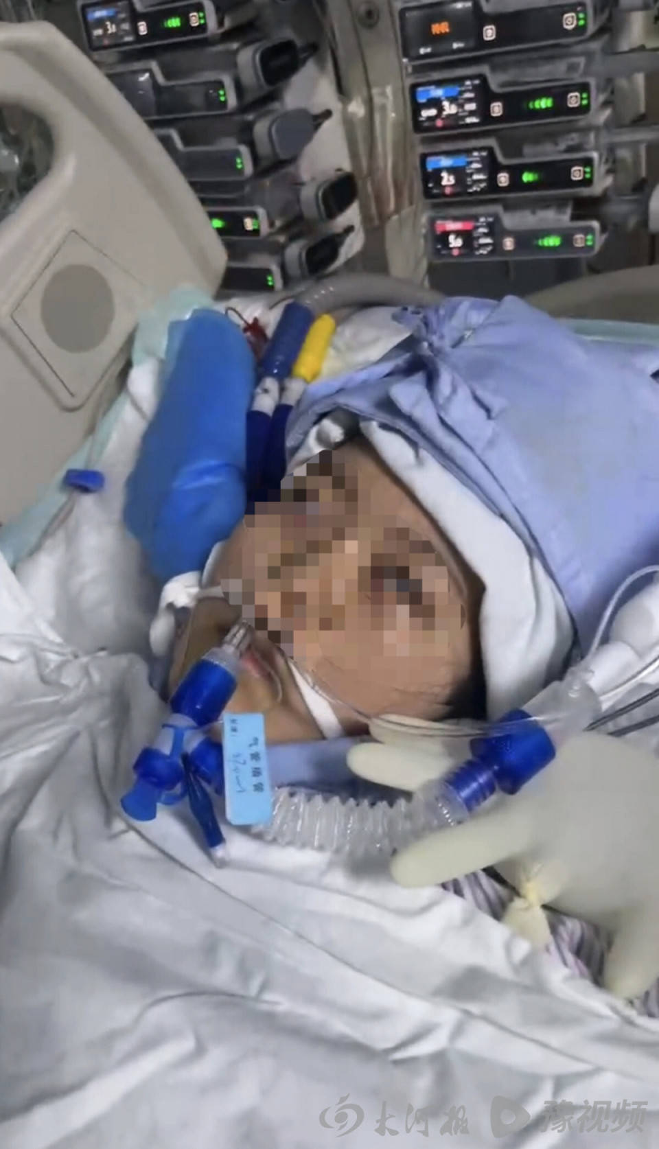 皇冠信用盘申请条件
_22岁美甲师手术成功却在复苏室脑死亡皇冠信用盘申请条件
，家属称缺氧30分钟监护医生未察觉，医院回应