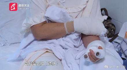 皇冠信用网注册
_女子水中捡漂亮石头装裤兜里被烧伤皇冠信用网注册
，医生：“石头”初步判定是磷